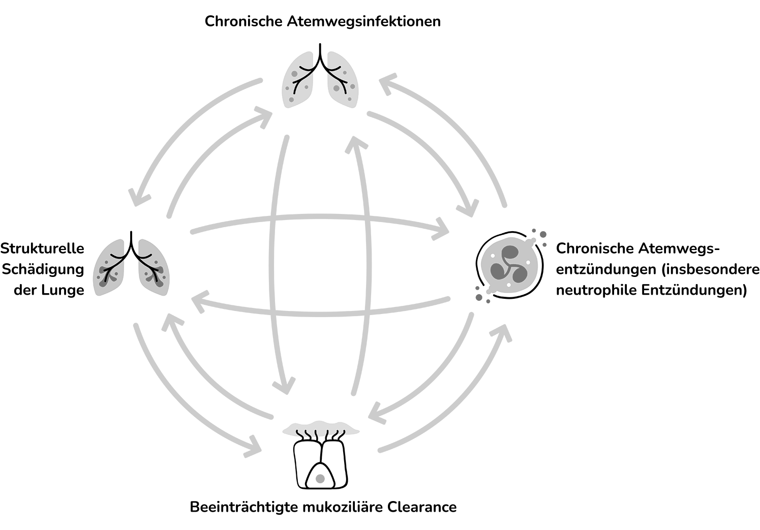 How the 4 drivers of bronchiectasis contribute to disease progression